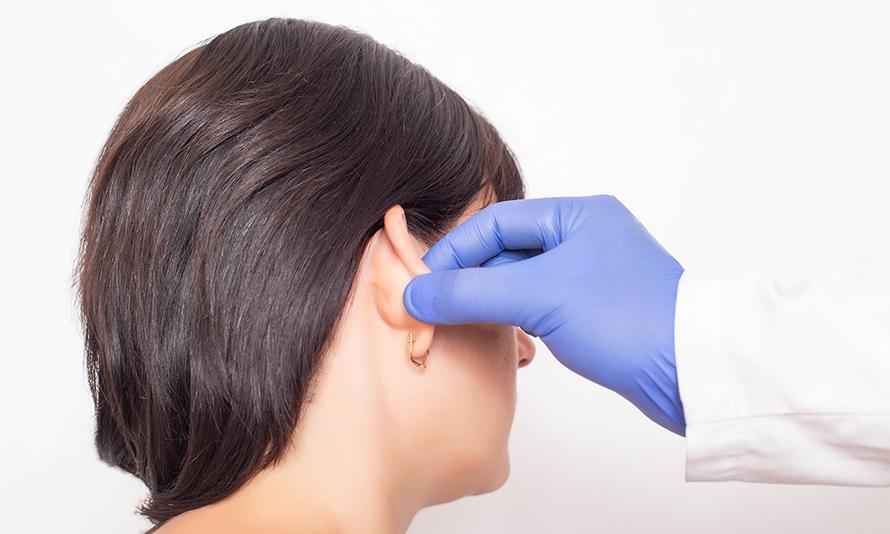 Unhappy Otoplasty