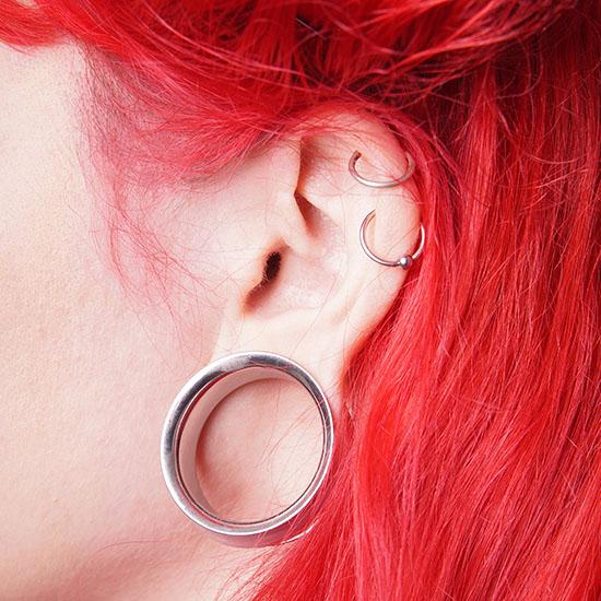 otoplasty earlobe repair
