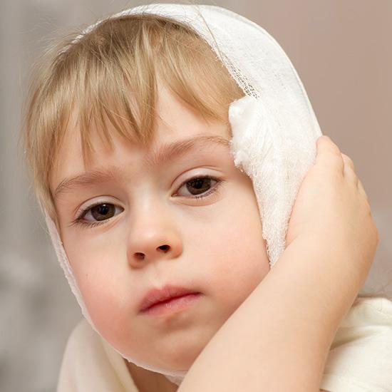 otoplasty for children